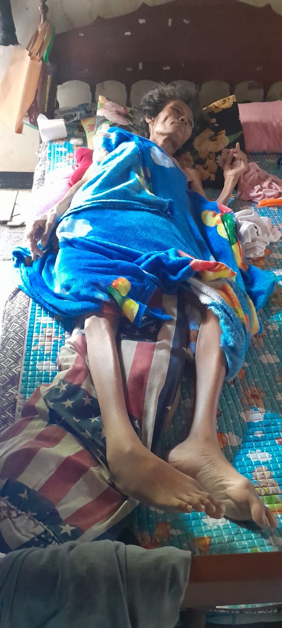 Warga Kedunggudel Sakit Menahun, Tidak Pernah Menerima Bantuan Pemerintah